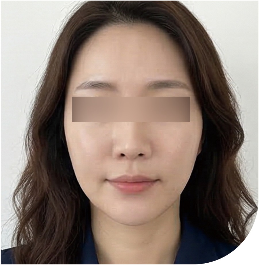 쥬베룩 · 인천 35 후 사진