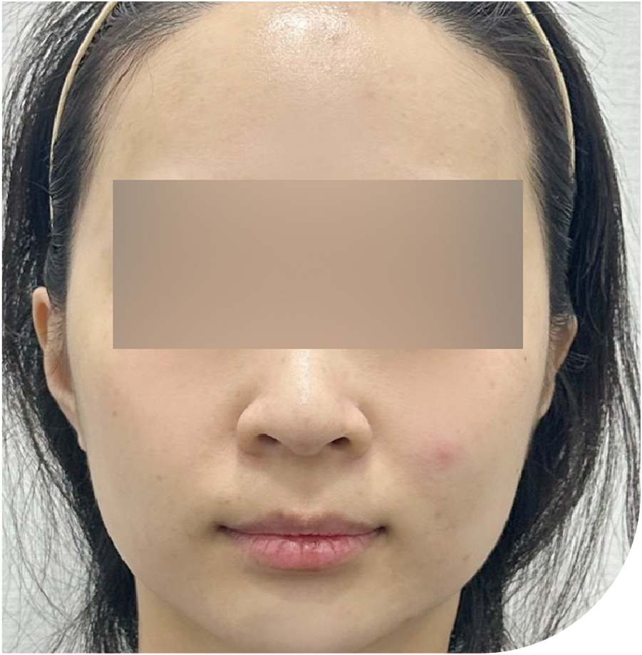 리쥬란힐러 · 인천 05 후 사진