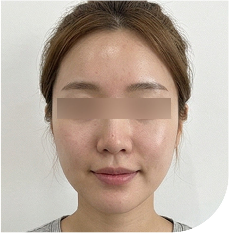 토닝 · 인천 37 후 사진