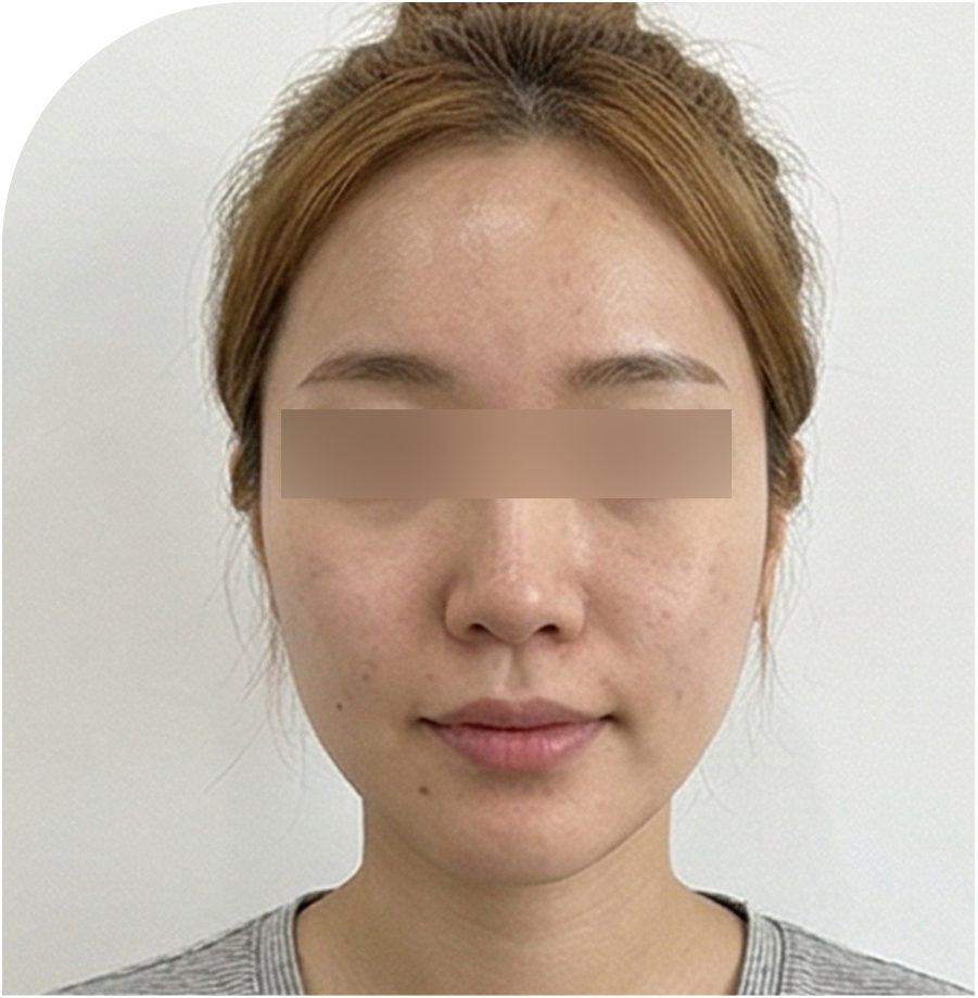 토닝 · 인천 37 전 사진