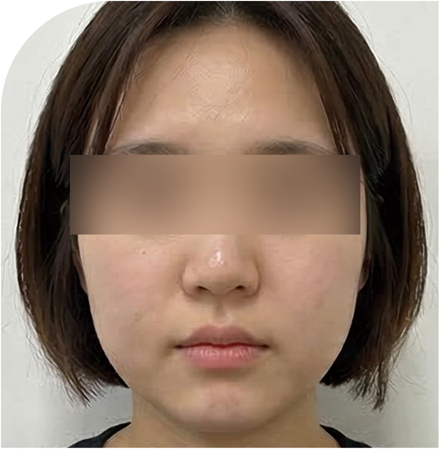 V핏 주사 · 인천 63 전 사진